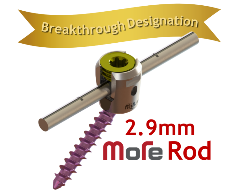 Posterior-Cervical-System-breakthrough-designation-3-762x1024